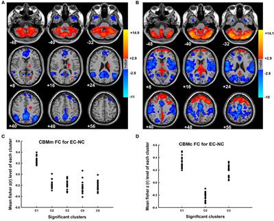 Altered Cerebellar Resting-State Functional Connectivity in Early-Stage Parkinson's Disease Patients With Cognitive Impairment
